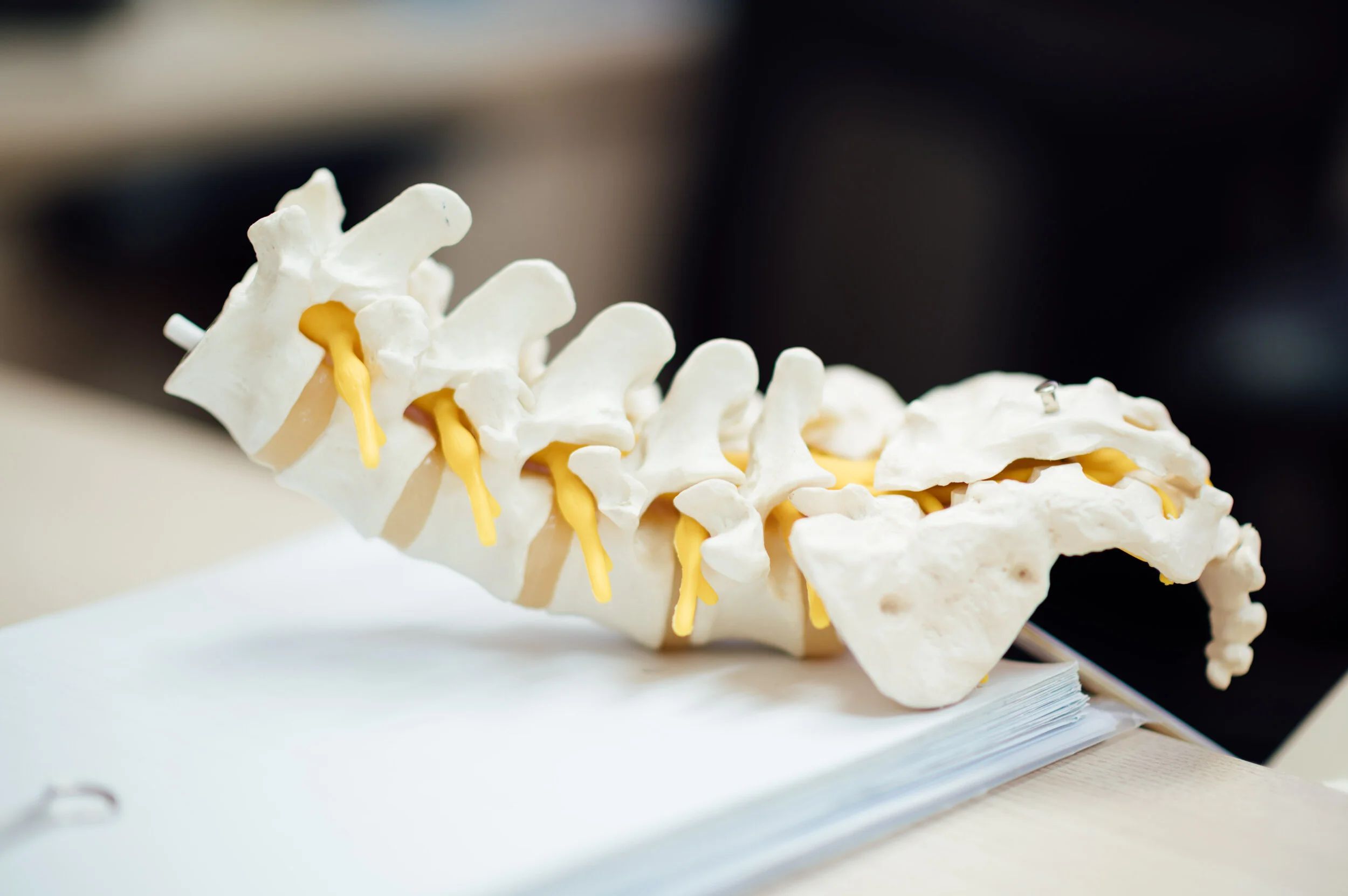 Model of the lumbar spine and sacrum showing the vertebrae, discs and spinal nerve roots.